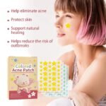 144pcs Colorful Star Acne Patches: Fade Pimple Marks, Clean Pores, Smooth Skin, Portable Pentagram Design