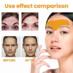 Forehead Wrinkle Fade and Smoothing Patch Can Lift the Face and Tighten the Skin