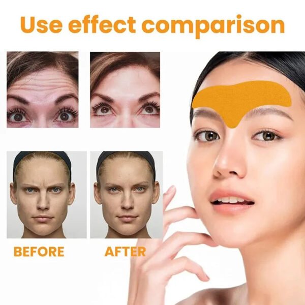 Forehead Wrinkle Fade and Smoothing Patch Can Lift the Face and Tighten the Skin