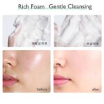 Whitening Facial Cleanser Foam, Moisturizing Deep Cleansing, Acne Milk, Oil Control, Exfoliating, Shrink Pores Face Wash.