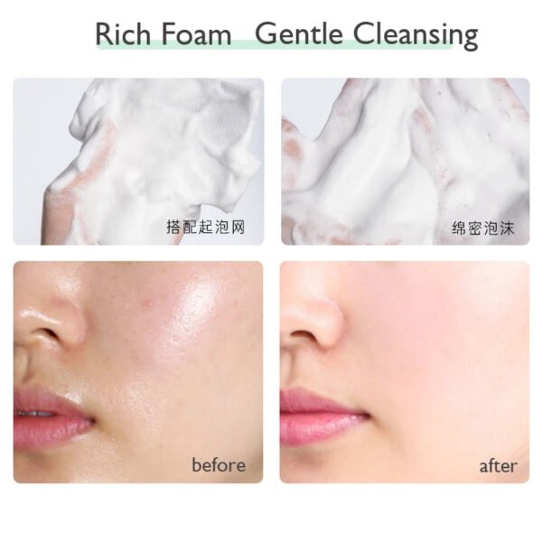 Whitening Facial Cleanser Foam, Moisturizing Deep Cleansing, Acne Milk, Oil Control, Exfoliating, Shrink Pores Face Wash.