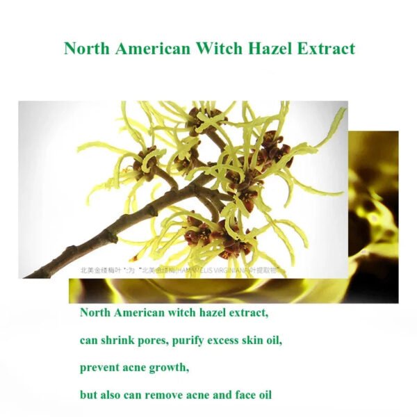 Herbal Acne Face Scar Treatment Cream   Blackhead Remover Repair Gel -Oil Control /Shrink Pores /Whitening Korean Skin Care