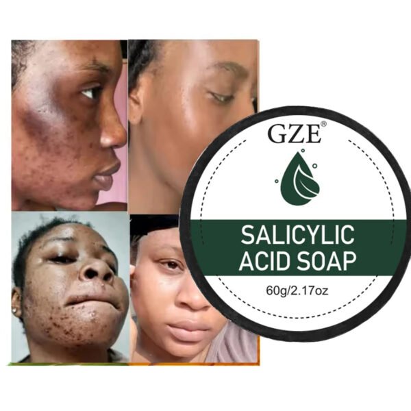 GZE Salicylic Acid Acne Soap for Pore Exfoliating and Softening Skin