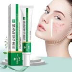 Herbal Acne Face Scar Treatment Cream   Blackhead Remover Repair Gel -Oil Control /Shrink Pores /Whitening Korean Skin Care