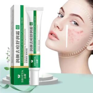 Herbal Acne Face Scar Treatment Cream   Blackhead Remover Repair Gel -Oil Control /Shrink Pores /Whitening Korean Skin Care