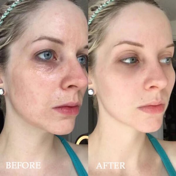 Korean Cosmetics Miracle Mask Polypeptide Hyaluronic Acid Kit Repairing Facial Collagen Lifting Firming Anti-aging Skin Care