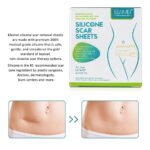 150cm Silicone Gel Scar Sheet Patch Treatment Cover Skin Repair Removal Tape for Acne, Burn Scar