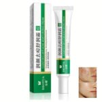 Herbal Acne Face Scar Treatment Cream   Blackhead Remover Repair Gel -Oil Control /Shrink Pores /Whitening Korean Skin Care