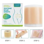 150cm Silicone Gel Scar Sheet Patch Treatment Cover Skin Repair Removal Tape for Acne, Burn Scar