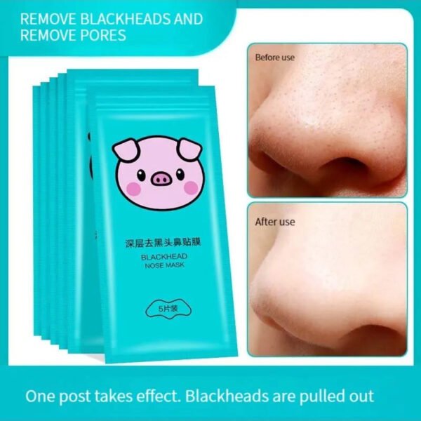 5PCS Blackhead Removal Nasal Strip