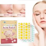 144pcs Colorful Star Acne Patches: Fade Pimple Marks, Clean Pores, Smooth Skin, Portable Pentagram Design