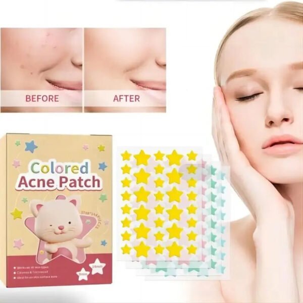 144pcs Colorful Star Acne Patches: Fade Pimple Marks, Clean Pores, Smooth Skin, Portable Pentagram Design